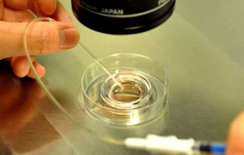 试管婴儿机构 代孕,y染色体微缺失能做试管吗多少钱！y染色体微缺失对身体有